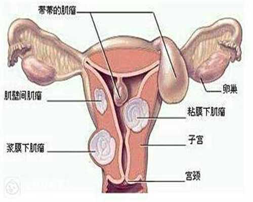 广州卵子库供卵费用清单?,广州供卵自怀费用明细_借卵助孕服务