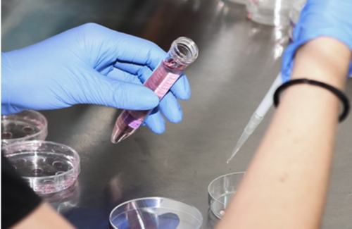 怀孕初期有褐色分泌物怎么办~试管代生孕