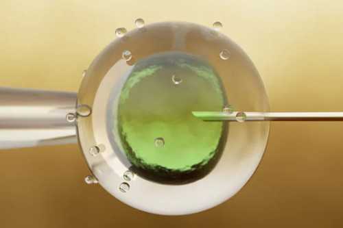 温州最有名的试管婴儿排名？温州做试管婴儿的医院！