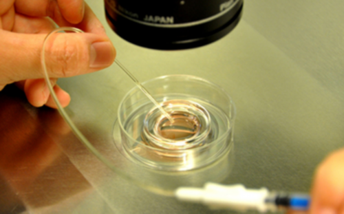 子宫畸形做试管成功率分析~代怀生孩子