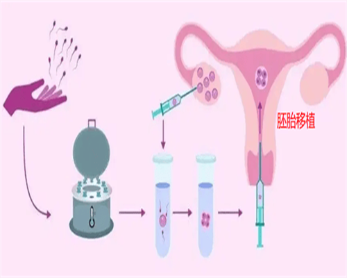 广州那些三甲医院做试管婴儿好