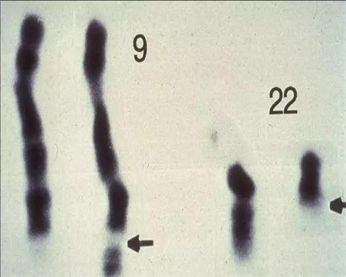 广州助孕婴儿一天打10多次喷嚏
