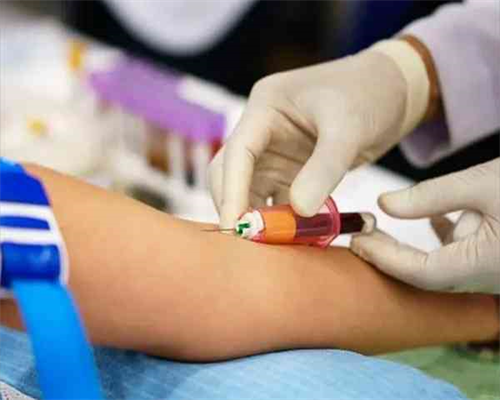 小下颌广州助孕婴儿的表现