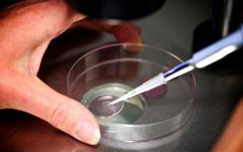 排卵障碍，这4种偏方针对不同类型可试试