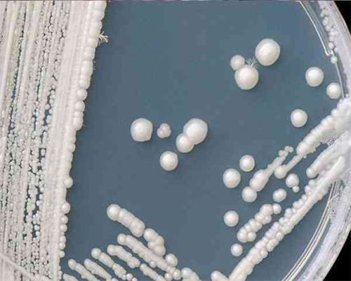 女性染色体异常在广州机构做三代试管婴儿多少钱？,借卵代生医院