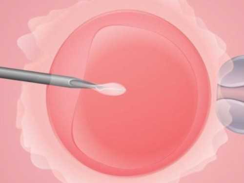 广州供卵试管婴儿医院,广州金贝供卵多少钱_有医院可以代孕吗