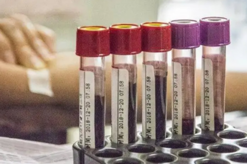 广州高龄供卵价格,两年未孕，子宫偏左，左侧输卵管通而不畅有粘连，右侧输