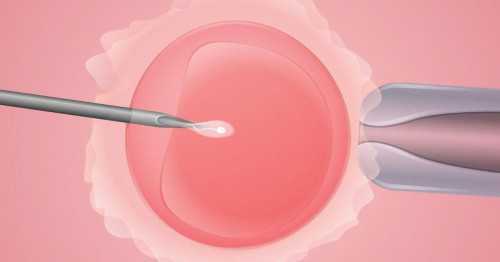 卵泡破裂出血别以为正常！若是这个原因,供卵代怀孩子