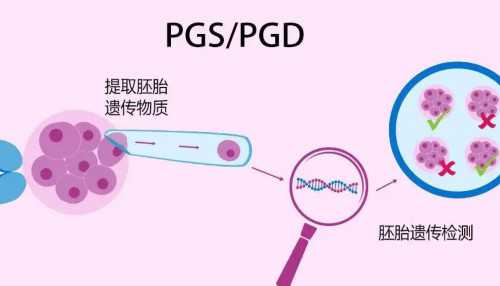 广州做供卵试管,广州金贝供卵医院简介_恶作剧之吻第一部演员表