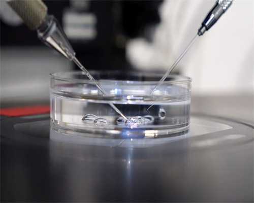 子宫内膜异位为何会被误诊子宫内膜异位的病因分析