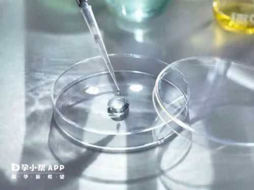 怀孕10周b超图,代生中介