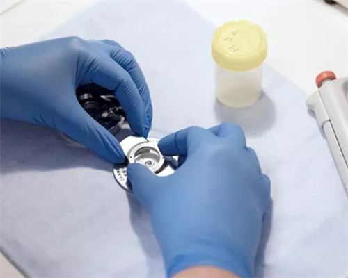 重组人促卵泡激素副作用和使用禁忌有哪些