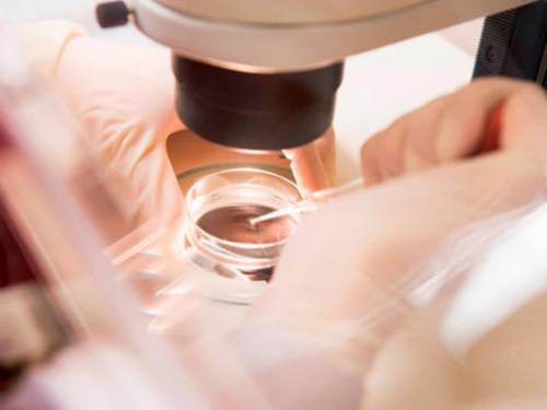 三维子宫附件彩超检查~代生怀孕机构