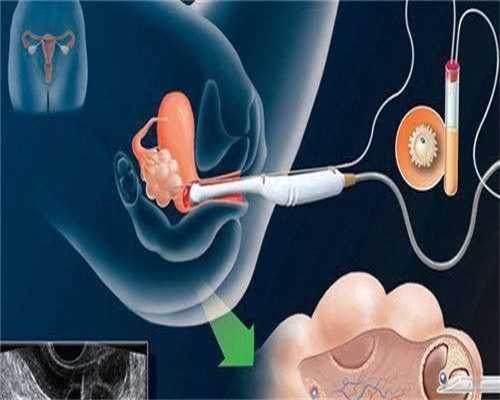 在广州供卵被骗说一下，广州供卵骗局有些什么套路？-正规代生网
