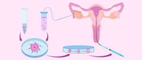 肛门湿疹有有下坠感吗 肛门湿疹有哪些症状,拉拉试管代怀