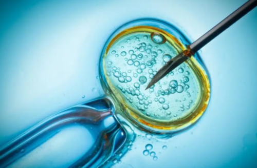 做完羊水穿刺之后应该注意什么？,代生孩价格