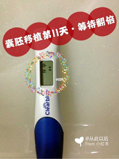 孕期胆汁淤积症怎么治疗？孕期胆汁淤积症有哪些表现？