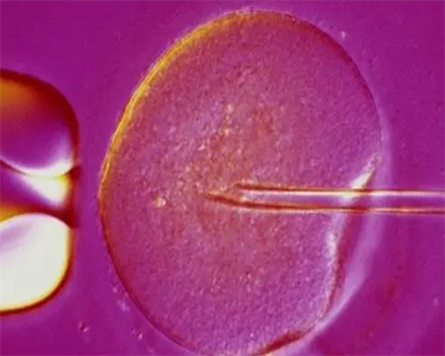 广州供卵助孕经验,[试管婴儿移植后注意事项]在广州医院做输卵管造影要预约吗